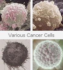 various cancer cells